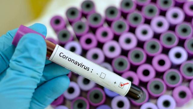 https://www.jornalacomarca.com.br/wp-content/uploads/2020/03/20200205123126_1200_675_-_coronavirus.jpg
